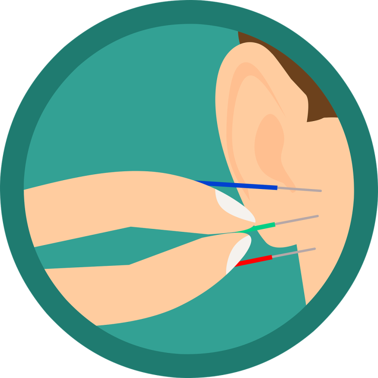 Acupunteur